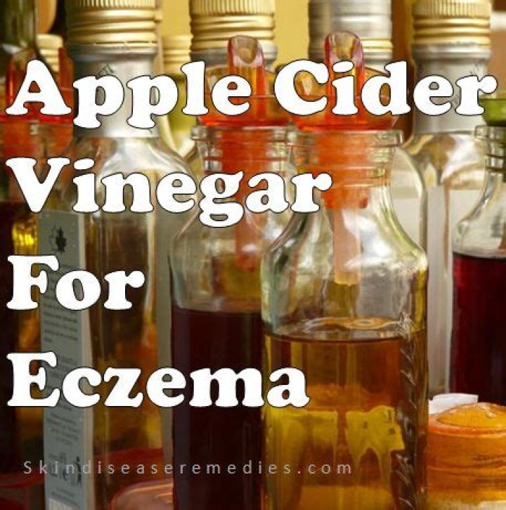 apple cider vinegar for eczema