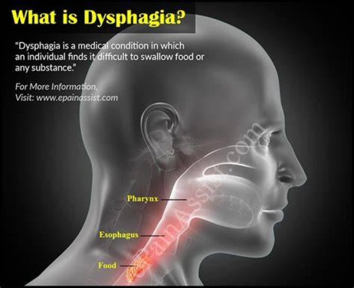 esophageal dysphagia icd 10