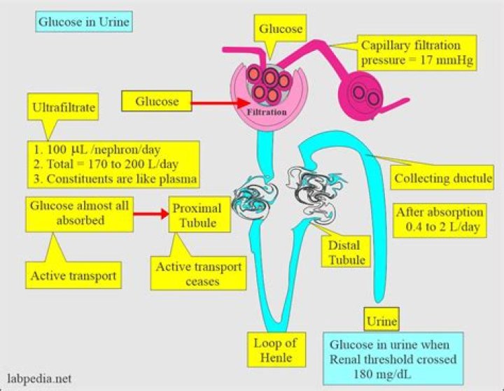 glucose in urine causes