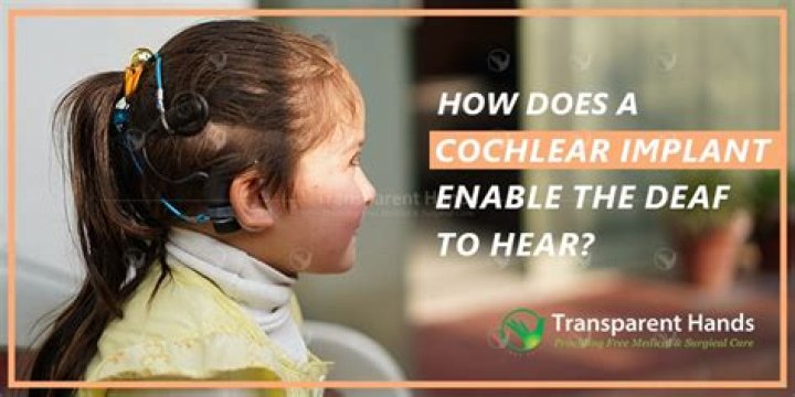 how does a cochlear implant enable the deaf to hear?