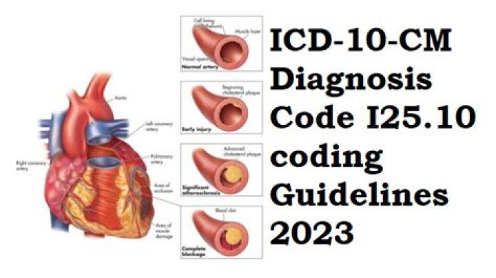i25.10 icd 10