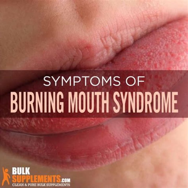 lips burning