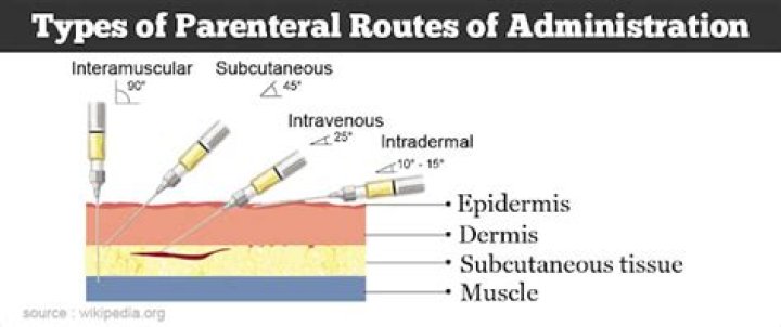 parenteral route of administration