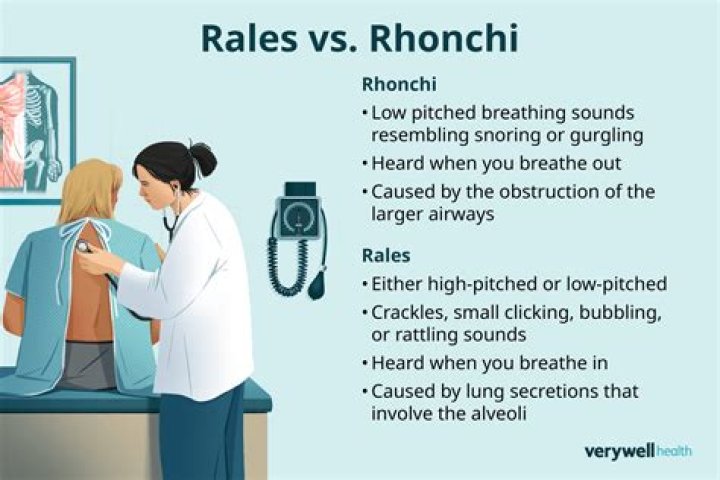 rhonchi definition