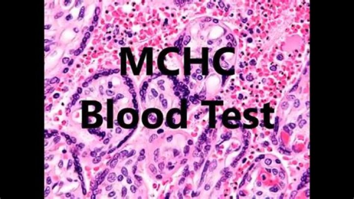 what is mchc in blood test low