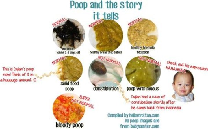 why does my poop smell like fish