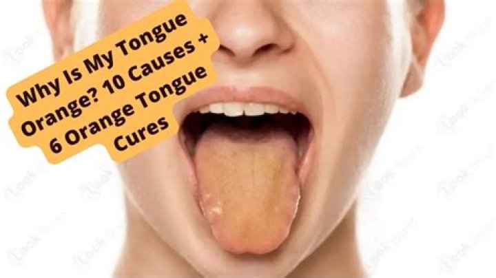 why is my tongue orange